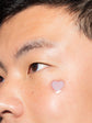 travel kit - case and 16 pimple patches